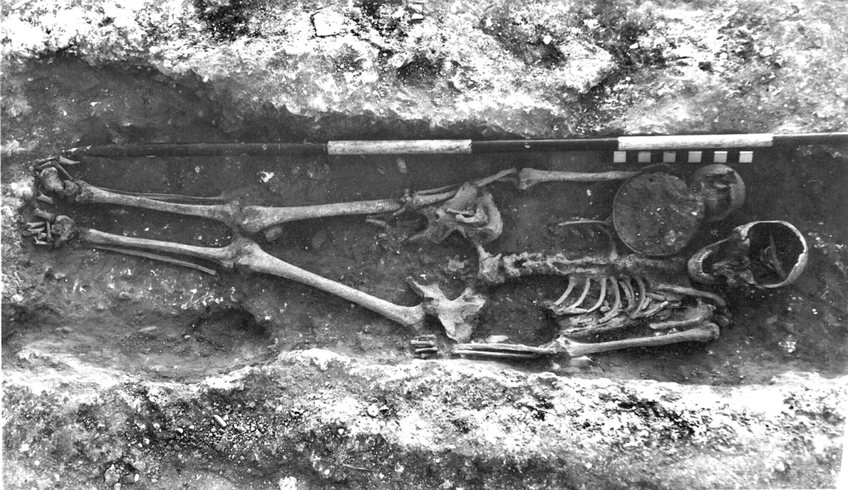 Înmormântare descoperită la Highsted în 1955, cu craniul parțial distrus de utilaje