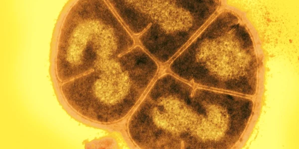 Deinococcus Radiodurans bacteria care supravietuieste pe marginea Statiei Spatiale foto via Micropia