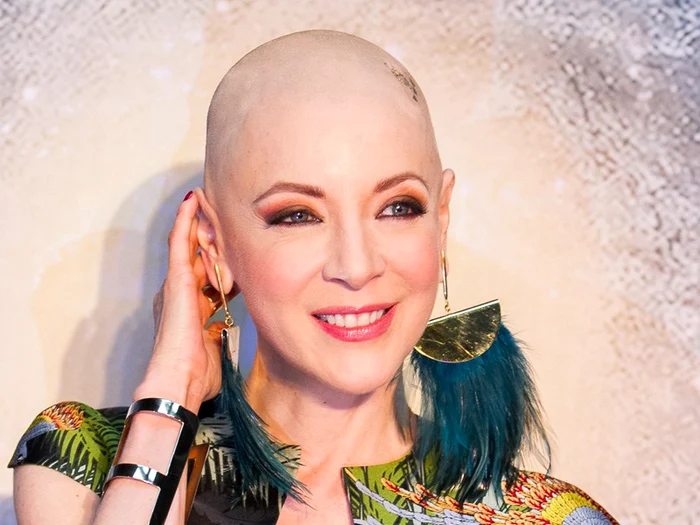 1 edith gonzailez cancer 28 abril 28042017 150908 jpg jpeg