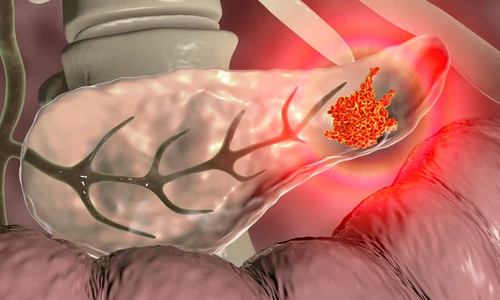 shutterstock 1605172135 jpg