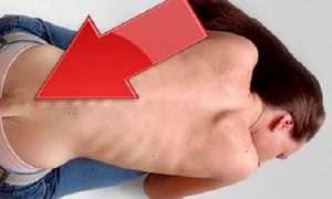 anomalii ale corpului uman  cum arata oamenii cu defecte fizice inedite jpeg