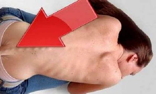 anomalii ale corpului uman  cum arata oamenii cu defecte fizice inedite jpeg