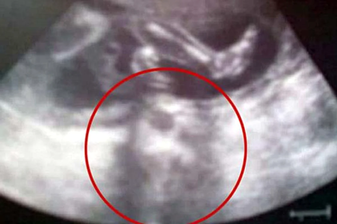 
    Foto: Daily Mail  
