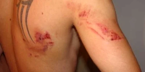 Târgovişte: UPDATE: "Am simţit pe piciorul meu laba ursului"