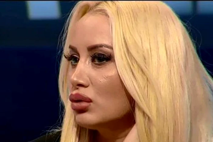 Simona Trașcă a mai făcut o intervenție estetică