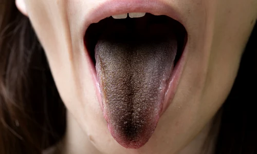 1 limba neagra paroasa jpg jpeg