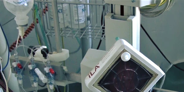 terapie ECMO   foto spital victor babes timișoara jpg