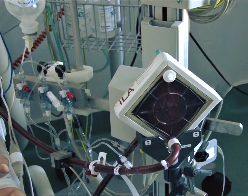 Aparatul permite preluarea funcțiilor plămânului/inimii FOTo: FB/Spital Victor Babeș Timișoara