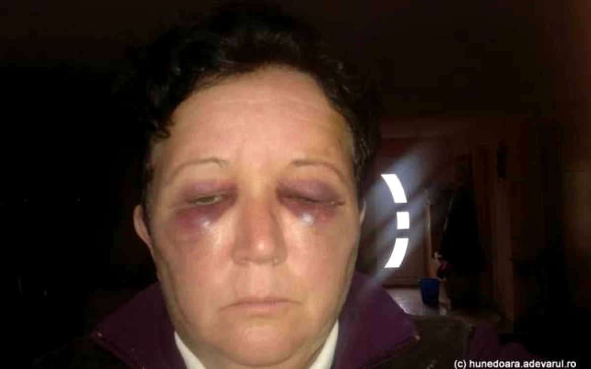 Verginica a susţinut că în ciuda plângerilor depuse, agresorul ei nu s-a potolit.