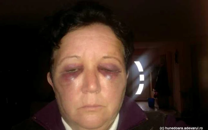 Verginica a susţinut că în ciuda plângerilor depuse, agresorul ei nu s-a potolit.