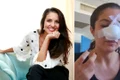 cristina joia a doua operatie la nas 3 jpeg