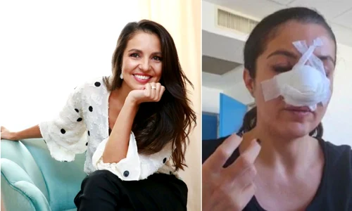 cristina joia a doua operatie la nas 3 jpeg