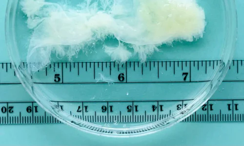 tesut avort 9 saptamanai 1 jpg webp