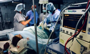 terapie intensva jpg