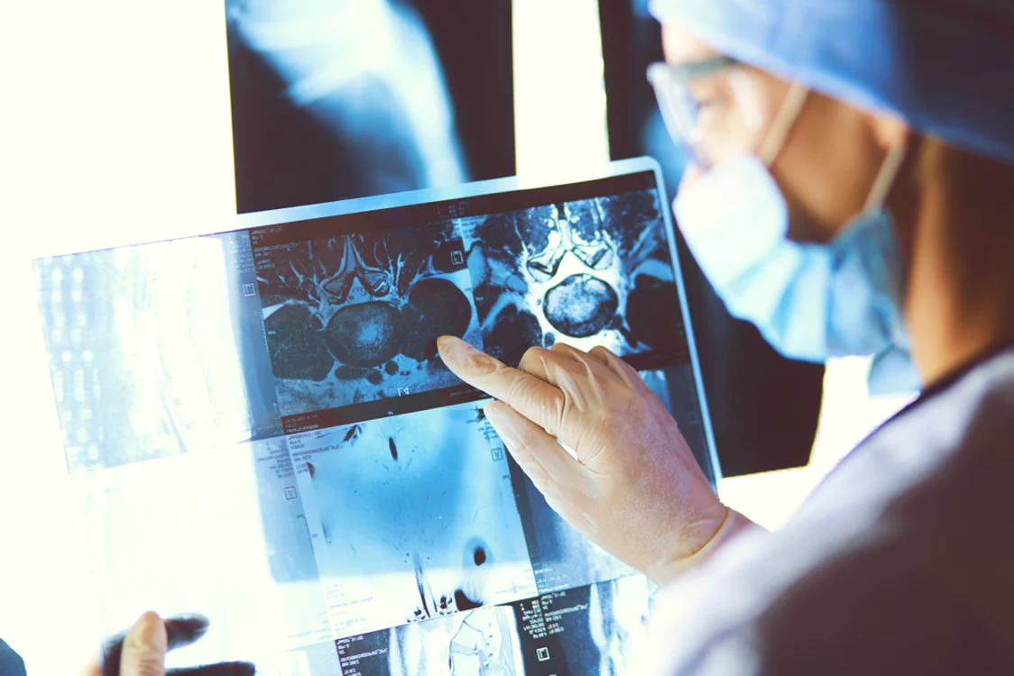 Un vaccin anticancer ar putea să apară până în 2030 FOTO Shutterstock