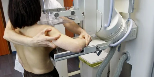 Examinarea radiologică a sânului prin mamografie