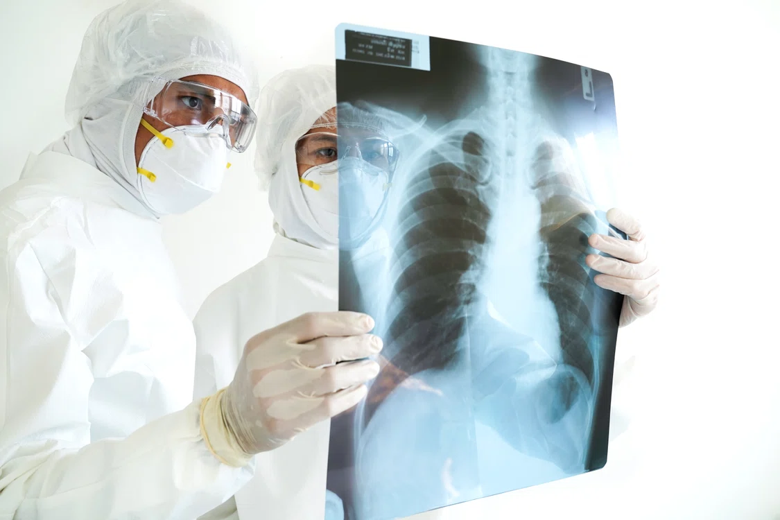 
    Este necesar un CT pulmonarFoto: Shutterstock  