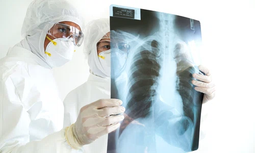 radiografie pulmonara shutter jpeg