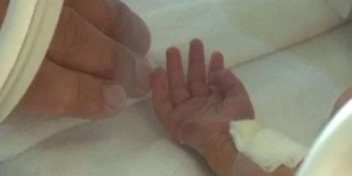 Copilul este internat la Chirurgie Infantila