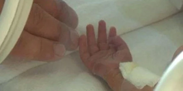 Copilul este internat la Chirurgie Infantila