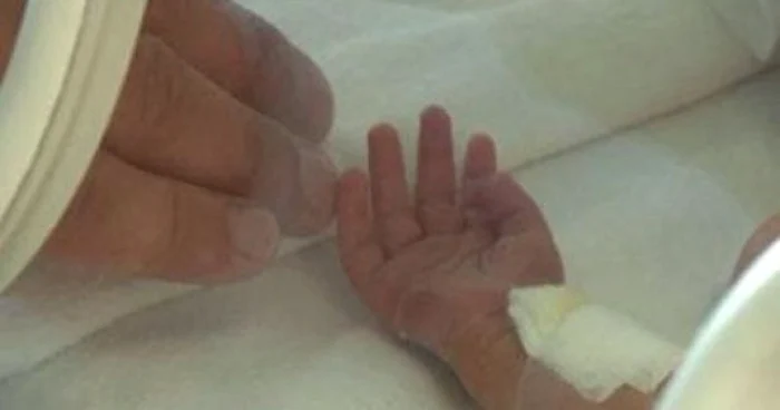 Copilul este internat la Chirurgie Infantila