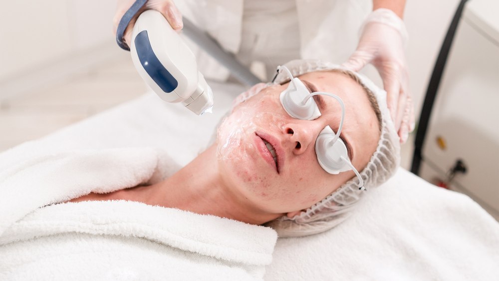 Aproape jumătate dintre cei care se confruntă cu acnee rămân cu cicatrici. Dr. Andreea Moroianu, MedLife: ,,Pentru a reduce cicatricile cauzate de acnee este important să se inițieze terapia eficientă cât mai devreme posibil”