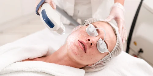 acnee 1920x1080px jpg