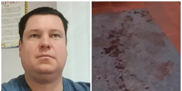 Un colaborator al administraţiei de ocupaţie a fost împuşcat în casa sa FOTO mil.in.ua