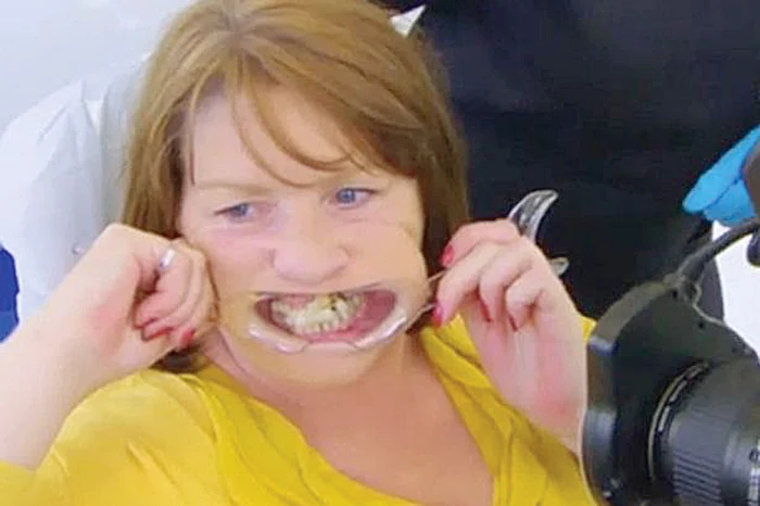 Angie Barlow (48 de ani) şi-a făcut praf dantura