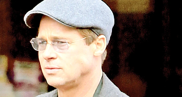 
    Chipul lui  poartă urmele  intervenţiilor  chirurgicale  