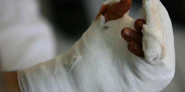 Unul dintre bătăuşi s-a ales cu mâna ruptă