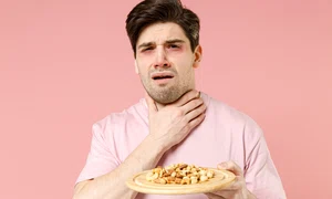 soc anafilactic jpg
