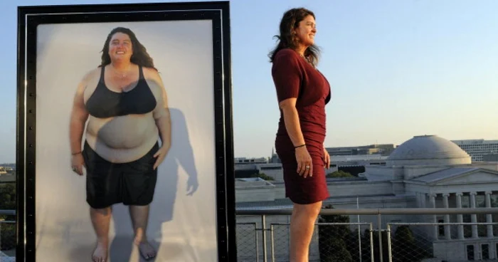 Transformare miraculoasă: Sally, în vârstă de 45 de ani suferă de obezitate încă din tinereţe FOTO GettyImages