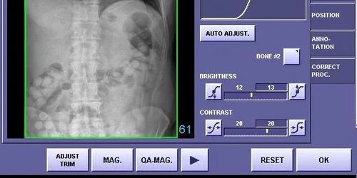 Radiografii incriminatorii