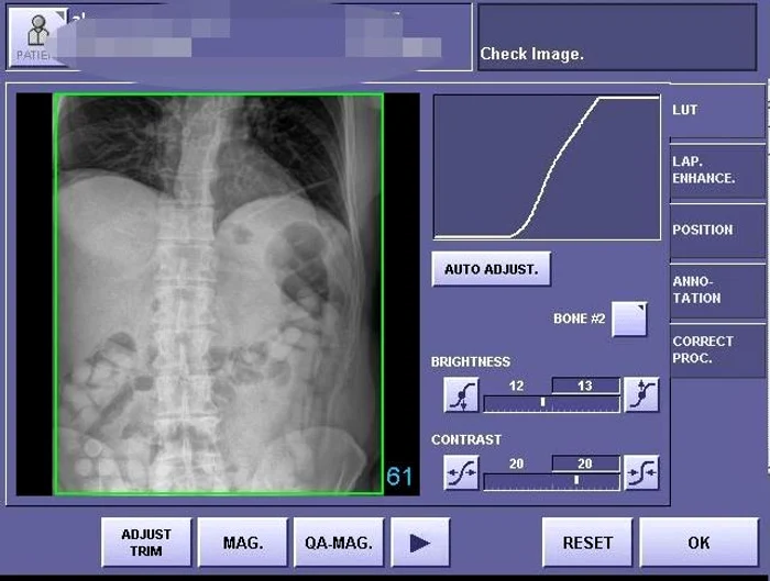 Radiografii incriminatorii