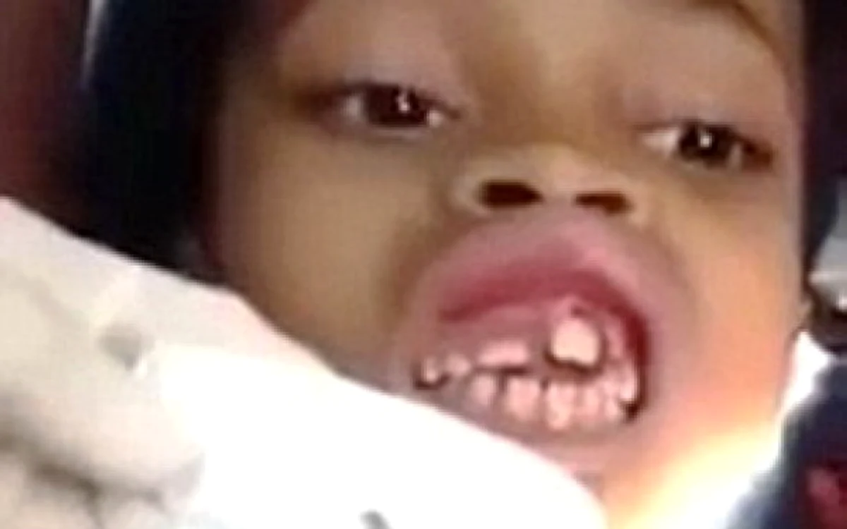 
    Ana Cardoso (10 ani) a rezistat cu stoicism cât timp dentistul i-au scos viermii din gurăcaptură: youtube.com  