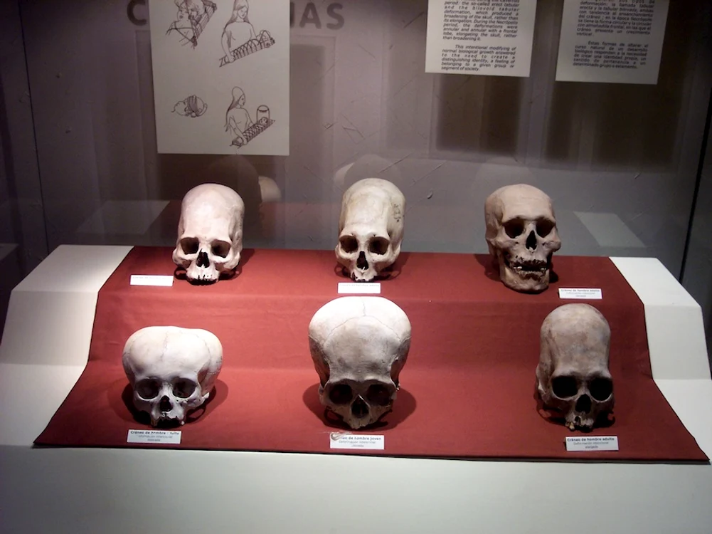 Cranii paracas FOTO wikipedia