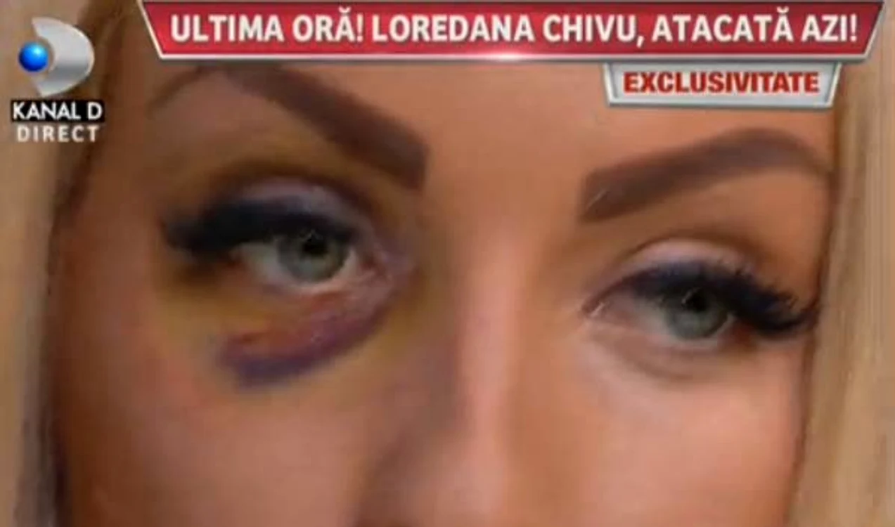 
    Foto: Captură Kanal D  