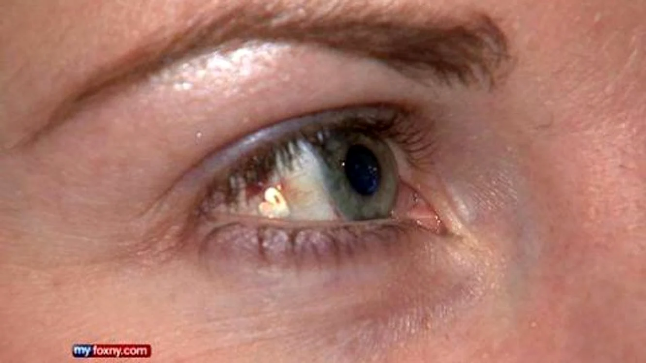 Lucy Luckayanko a cerut medicilor din New York să-i insereze o inimă din platină pe globul ocular FOTO: Captură Foto