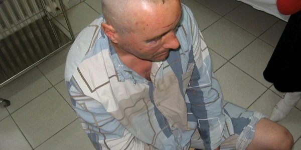 Bărbatul s-a ales cu multiple tăieturi adânci Foto:Adrian Obreja    