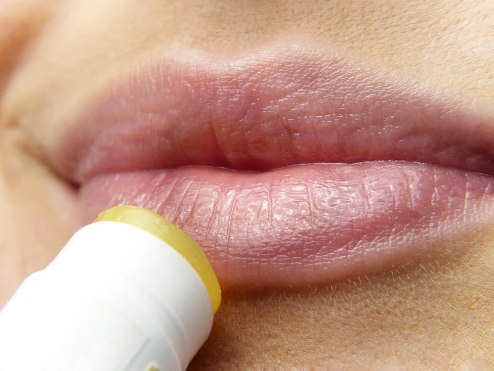 Planta care te ajută să scapi de herpes / foto: Pixabay 