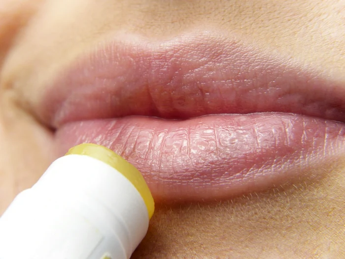 Planta care te ajută să scapi de herpes / foto: Pixabay