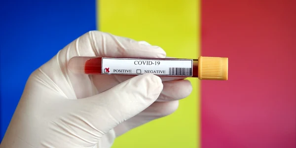 Coronavirus covid Romania FOTO Shutterstock