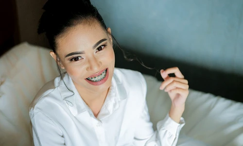 1 aparat dentar 2 jpg jpeg