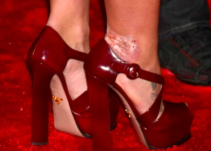 Britney se afișează cu rana de la picior (FOTO The Sun/Alpha Press)