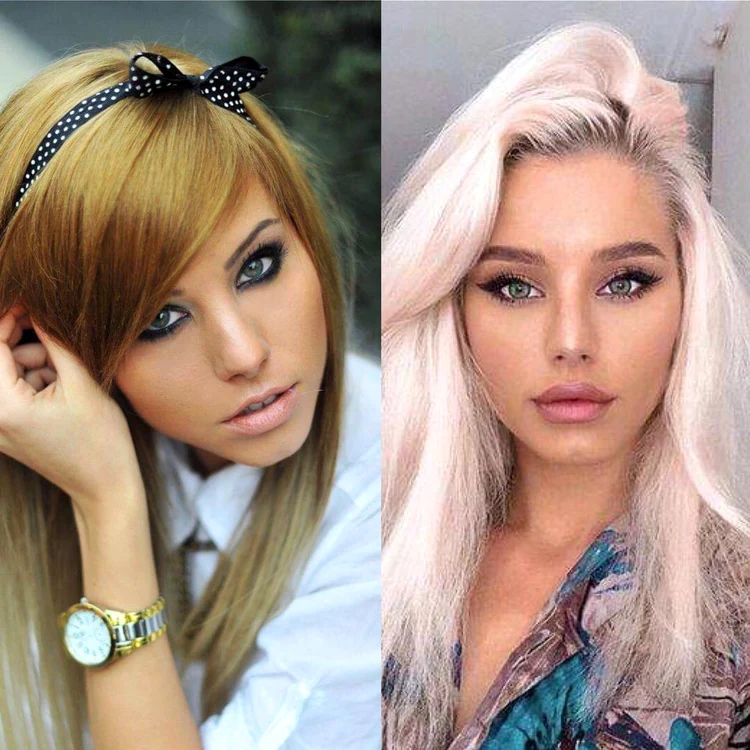 Carmen Grebenișan, după operațiile estetice