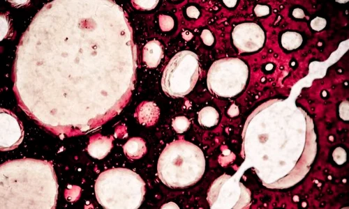 celule cancer 600x400 jpeg