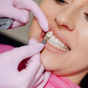 fatete dentare cine este candidat potrivit si cine nu jpg