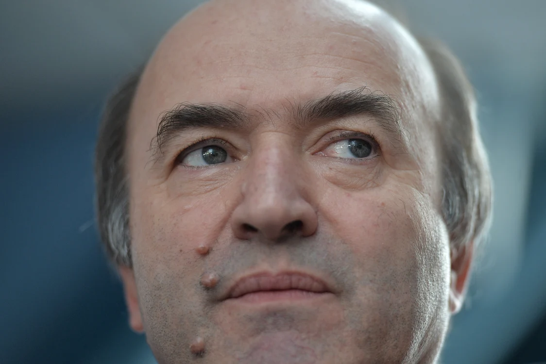 
    Așa arăta fața lui Tudorel Toder la întoarcerea din concediul de la sfârșitul lunii martiefoto: Mediafax  