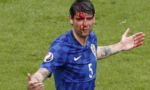 Corluka a jucat cu sangele siroindu i pe fata jpeg